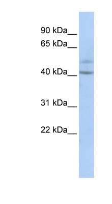 Western Blot: SPATC1 Antibody [NBP1-56808]