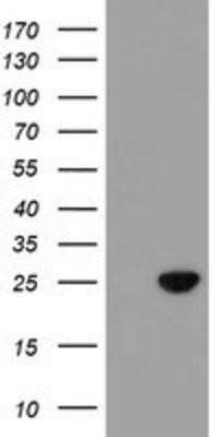 Western Blot: SPATC1L Antibody (OTI1H6)Azide and BSA Free [NBP2-72277]