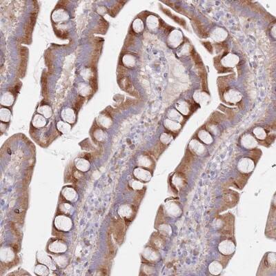 Immunohistochemistry-Paraffin: SPATS1 Antibody [NBP2-31037]