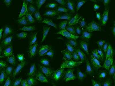 Immunocytochemistry/ Immunofluorescence: SPATS2 Antibody [NBP2-97797]