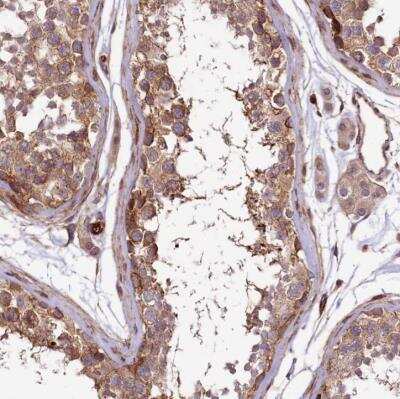 Immunohistochemistry-Paraffin: SPATS2 Antibody [NBP1-82269]