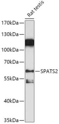 Western Blot: SPATS2 AntibodyAzide and BSA Free [NBP3-04573]