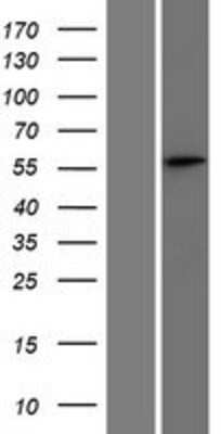 Western Blot: SPATS2 Overexpression Lysate [NBP2-06386]