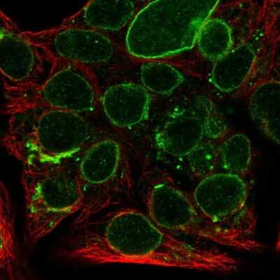 Immunocytochemistry/ Immunofluorescence: SPC18 Antibody [NBP2-57129]