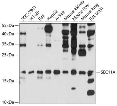 Western Blot: SPC18 AntibodyAzide and BSA Free [NBP2-94187]