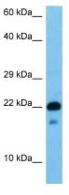 Western Blot: SPC18 Antibody [NBP3-10181]