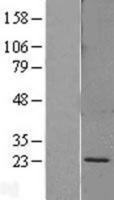 Western Blot: SPC18 Overexpression Lysate [NBL1-15772]