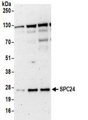 Western Blot: SPC24 Antibody [NBP2-32105]