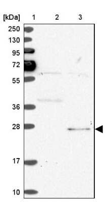 Western Blot: SPC24 Antibody [NBP2-47264]