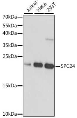 Western Blot: SPC24 AntibodyAzide and BSA Free [NBP2-94700]