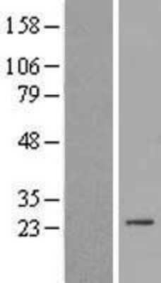 Western Blot: SPC24 Overexpression Lysate [NBL1-16386]