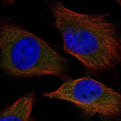 Immunocytochemistry/ Immunofluorescence: SPC25 Antibody [NBP2-47263]