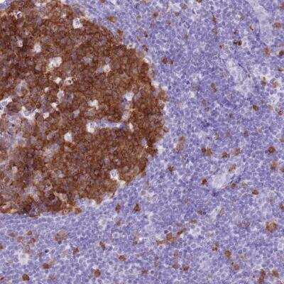 Immunohistochemistry-Paraffin: SPC25 Antibody [NBP2-47263]