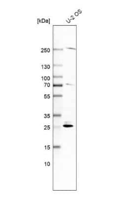 Western Blot: SPC25 Antibody [NBP2-47263]