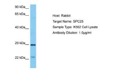 Western Blot: SPC25 Antibody [NBP2-88280]