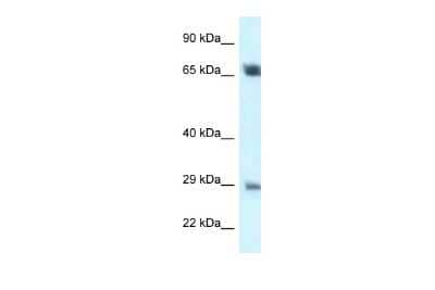 Western Blot: SPC25 Antibody [NBP2-88350]