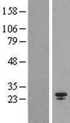 Western Blot: SPC25 Overexpression Lysate [NBL1-16387]