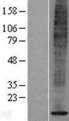 Western Blot: SPCS1 Overexpression Lysate [NBL1-16388]