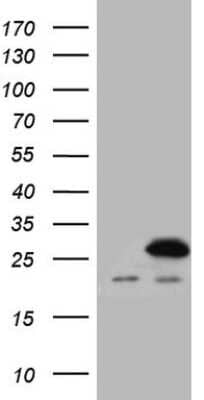 Western Blot: SPCS2 Antibody (OTI1E4) [NBP2-45942]