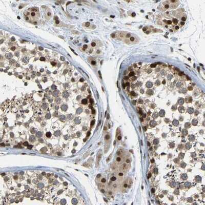 Immunohistochemistry-Paraffin: SPCS2 Antibody [NBP1-93656]