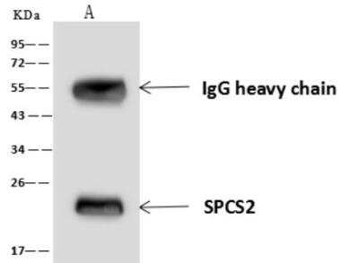 Immunoprecipitation: SPCS2 Antibody [NBP3-06490]