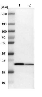 Western Blot: SPCS2 Antibody [NBP1-93656]