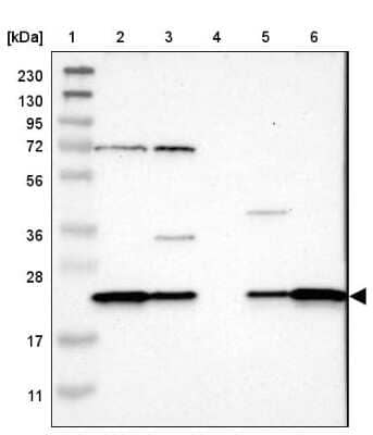 Western Blot: SPCS2 Antibody [NBP1-93656]