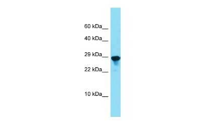 Western Blot: SPCS2 Antibody [NBP2-88353]