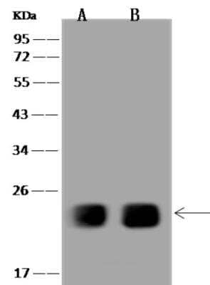 Western Blot: SPCS2 Antibody [NBP3-06490]