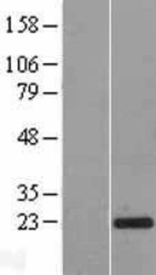 Western Blot: SPCS3 Overexpression Lysate [NBL1-16389]