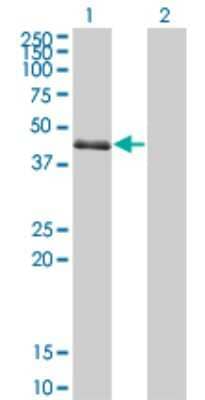 Western Blot: SPDEF Antibody (4A5) [H00025803-M01]