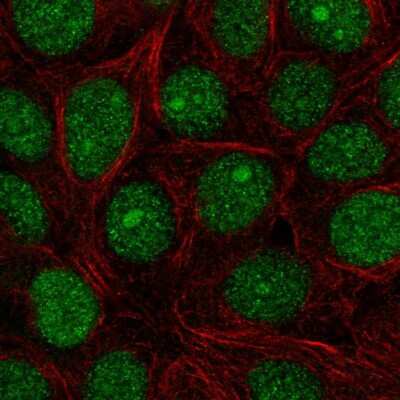 Immunocytochemistry/ Immunofluorescence: SPDEF Antibody [NBP2-56499]