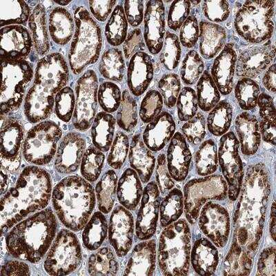 Immunohistochemistry-Paraffin: SPDYC Antibody [NBP1-80832]