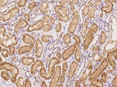 Immunohistochemistry-Paraffin: SPDYC Antibody [NBP2-98160]