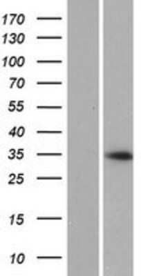 Western Blot: SPDYC Overexpression Lysate [NBP2-08798]