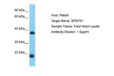 Western Blot: SPDYE1 Antibody [NBP2-83585]