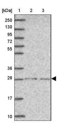 Western Blot: SPDYE1 Antibody [NBP2-46794]