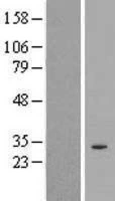 Western Blot: SPDYE2 Overexpression Lysate [NBP2-08597]