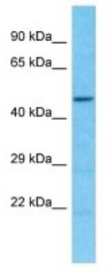 Western Blot: SPDYE2B Antibody [NBP3-09890]