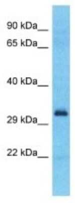 Western Blot: SPDYE2B Antibody [NBP3-09891]