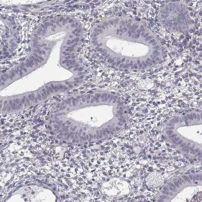 Immunohistochemistry-Paraffin: SPDYE4 Antibody [NBP1-91055]