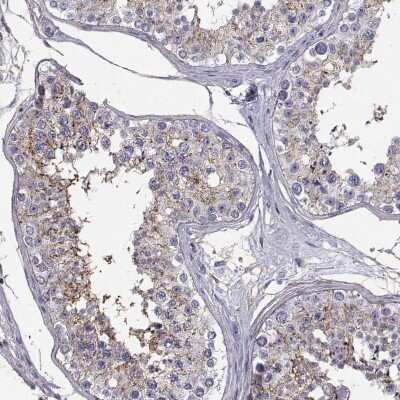 Immunohistochemistry-Paraffin: SPDYE4 Antibody [NBP1-91055]