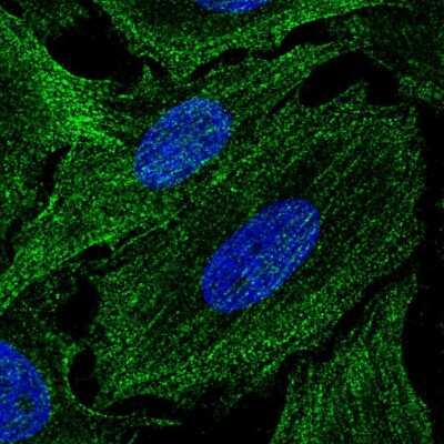 Immunocytochemistry/ Immunofluorescence: SPECC1L Antibody [NBP2-49640]