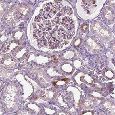 Immunohistochemistry-Paraffin: SPECC1L Antibody [NBP2-49640]