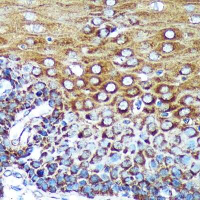 Immunohistochemistry-Paraffin: SPECC1L Antibody - Azide and BSA Free [NBP2-94163]