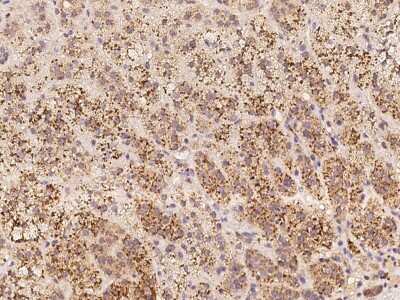 Immunohistochemistry-Paraffin: SPECC1L Antibody [NBP2-98024]