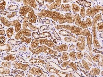 Immunohistochemistry-Paraffin: SPECC1L Antibody [NBP2-98024]