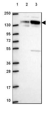 Western Blot: SPECC1L Antibody [NBP2-49640]