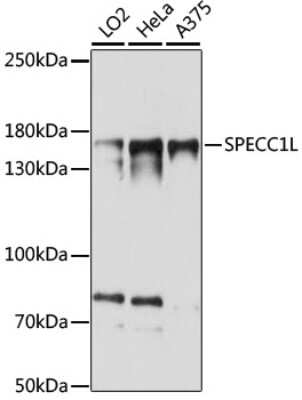 Western Blot: SPECC1L AntibodyAzide and BSA Free [NBP2-94163]