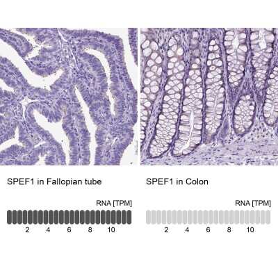 Immunohistochemistry-Paraffin: SPEF1 Antibody [NBP2-14707]
